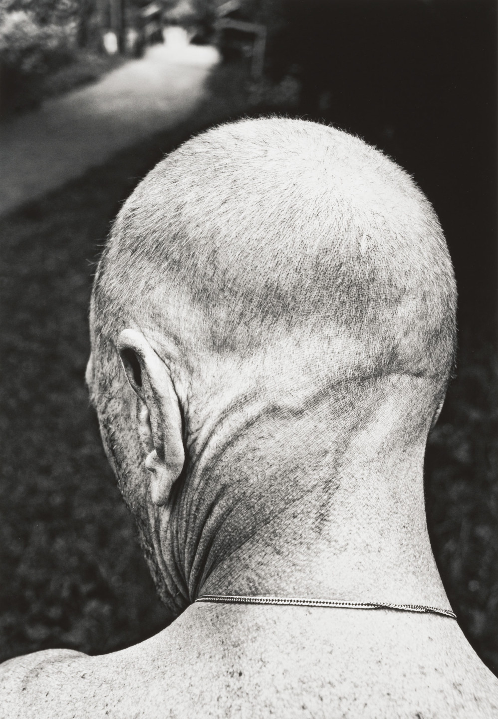 Photograph depicting a man's neck
